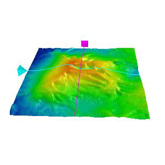 Cartographie d'une membrane épirétinienne